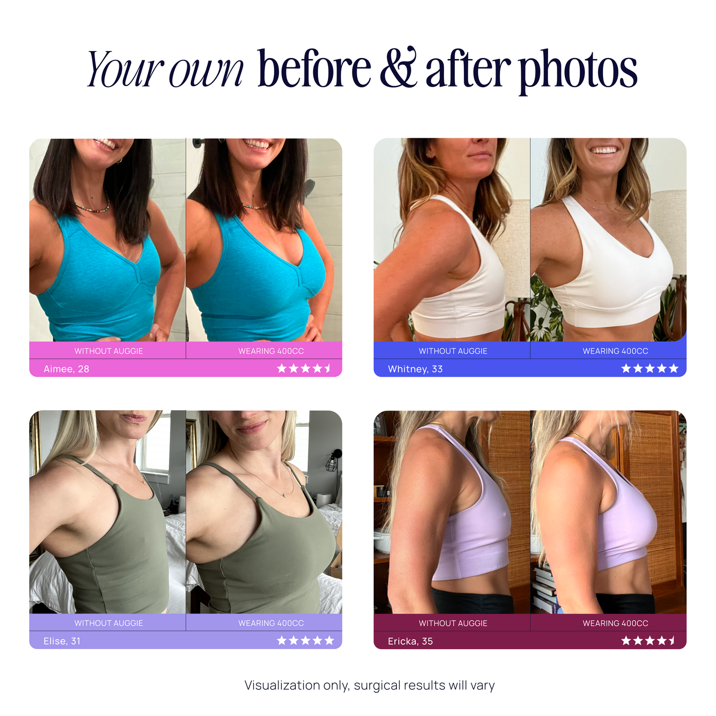 Breast Implant Sizers Kit
